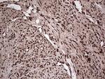 SAE1 Antibody in Immunohistochemistry (Paraffin) (IHC (P))