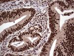 SAE1 Antibody in Immunohistochemistry (Paraffin) (IHC (P))