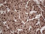 SAE1 Antibody in Immunohistochemistry (Paraffin) (IHC (P))