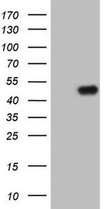 TRIB1 Antibody in Western Blot (WB)