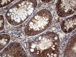 GARS Antibody in Immunohistochemistry (Paraffin) (IHC (P))