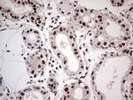 SAE1 Antibody in Immunohistochemistry (Paraffin) (IHC (P))