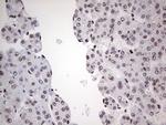 SAE1 Antibody in Immunohistochemistry (Paraffin) (IHC (P))