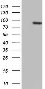 HDAC9 Antibody in Western Blot (WB)