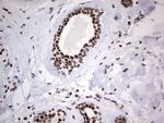 HDAC9 Antibody in Immunohistochemistry (Paraffin) (IHC (P))