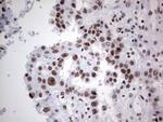 HDAC9 Antibody in Immunohistochemistry (Paraffin) (IHC (P))