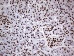 HDAC9 Antibody in Immunohistochemistry (Paraffin) (IHC (P))