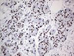 HDAC9 Antibody in Immunohistochemistry (Paraffin) (IHC (P))