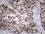 HDAC9 Antibody in Immunohistochemistry (Paraffin) (IHC (P))