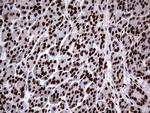 hnRNP L Antibody in Immunohistochemistry (Paraffin) (IHC (P))