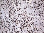 hnRNP L Antibody in Immunohistochemistry (Paraffin) (IHC (P))