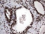 hnRNP L Antibody in Immunohistochemistry (Paraffin) (IHC (P))