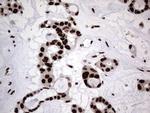 hnRNP L Antibody in Immunohistochemistry (Paraffin) (IHC (P))