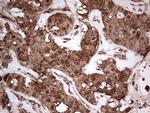 NUDT12 Antibody in Immunohistochemistry (Paraffin) (IHC (P))