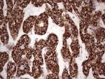 CANT1 Antibody in Immunohistochemistry (Paraffin) (IHC (P))