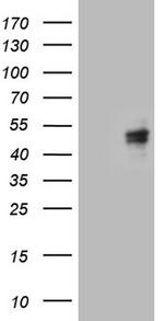 CANT1 Antibody in Western Blot (WB)