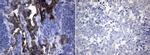 ROS1 Antibody in Immunohistochemistry (Paraffin) (IHC (P))