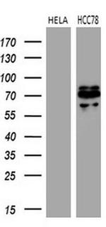 ROS1 Antibody in Western Blot (WB)