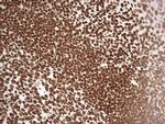 SETD1A Antibody in Immunohistochemistry (Paraffin) (IHC (P))