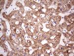 LRRC6 Antibody in Immunohistochemistry (Paraffin) (IHC (P))