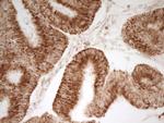 MRRF Antibody in Immunohistochemistry (Paraffin) (IHC (P))