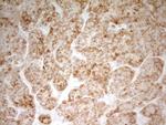 MRRF Antibody in Immunohistochemistry (Paraffin) (IHC (P))