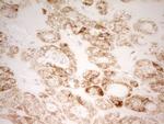 MRRF Antibody in Immunohistochemistry (Paraffin) (IHC (P))