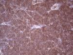 Angiopoietin 2 Antibody in Immunohistochemistry (Paraffin) (IHC (P))