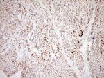 NR0B2 Antibody in Immunohistochemistry (Paraffin) (IHC (P))