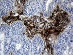 MGP Antibody in Immunohistochemistry (Paraffin) (IHC (P))