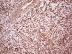 UBE2D2 Antibody in Immunohistochemistry (Paraffin) (IHC (P))