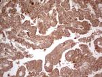 UBE2D2 Antibody in Immunohistochemistry (Paraffin) (IHC (P))