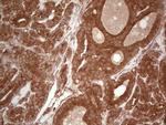 UBE2D2 Antibody in Immunohistochemistry (Paraffin) (IHC (P))