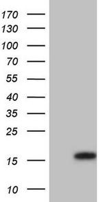 UBE2D2 Antibody in Western Blot (WB)