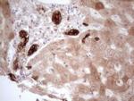 PHGDH Antibody in Immunohistochemistry (Paraffin) (IHC (P))