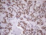 NUDT21 Antibody in Immunohistochemistry (Paraffin) (IHC (P))