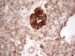 ABAT Antibody in Immunohistochemistry (Paraffin) (IHC (P))