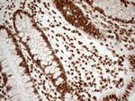 ALOX5 Antibody in Immunohistochemistry (Paraffin) (IHC (P))