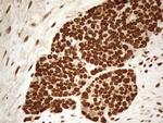 ALOX5 Antibody in Immunohistochemistry (Paraffin) (IHC (P))