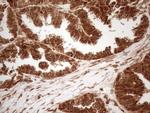 ALOX5 Antibody in Immunohistochemistry (Paraffin) (IHC (P))