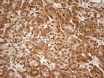 ALOX5 Antibody in Immunohistochemistry (Paraffin) (IHC (P))