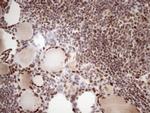 53BP1 Antibody in Immunohistochemistry (Paraffin) (IHC (P))