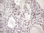 53BP1 Antibody in Immunohistochemistry (Paraffin) (IHC (P))