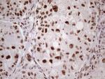 53BP1 Antibody in Immunohistochemistry (Paraffin) (IHC (P))