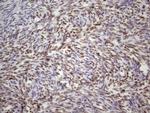 53BP1 Antibody in Immunohistochemistry (Paraffin) (IHC (P))