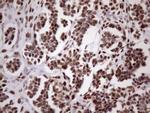 53BP1 Antibody in Immunohistochemistry (Paraffin) (IHC (P))