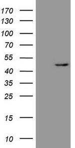 Renin Antibody in Western Blot (WB)