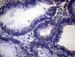 PAPSS2 Antibody in Immunohistochemistry (Paraffin) (IHC (P))