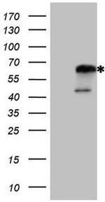 NR2C2 Antibody in Western Blot (WB)