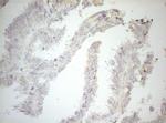 Carboxypeptidase M Antibody in Immunohistochemistry (Paraffin) (IHC (P))